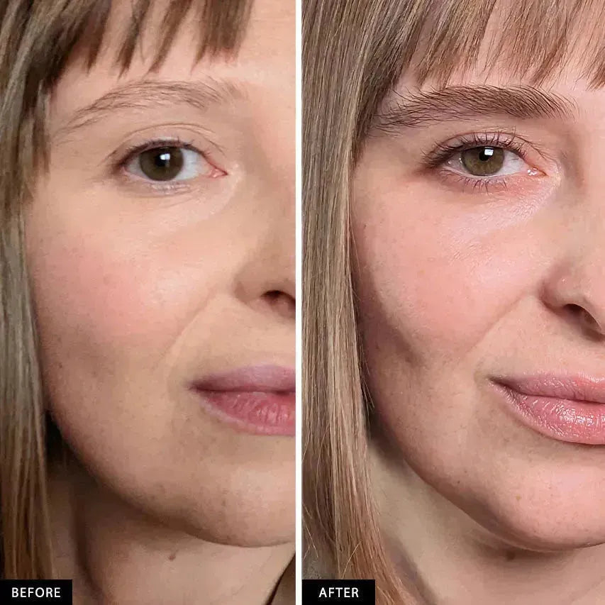Before and after close-up of woman&