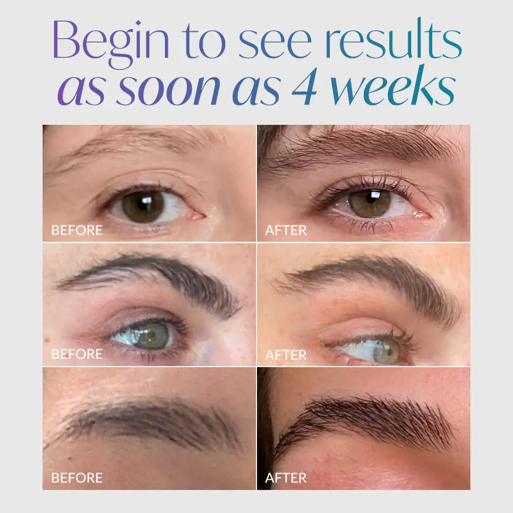 Before and after eyelash and eyebrow enhancement results in 4 weeks